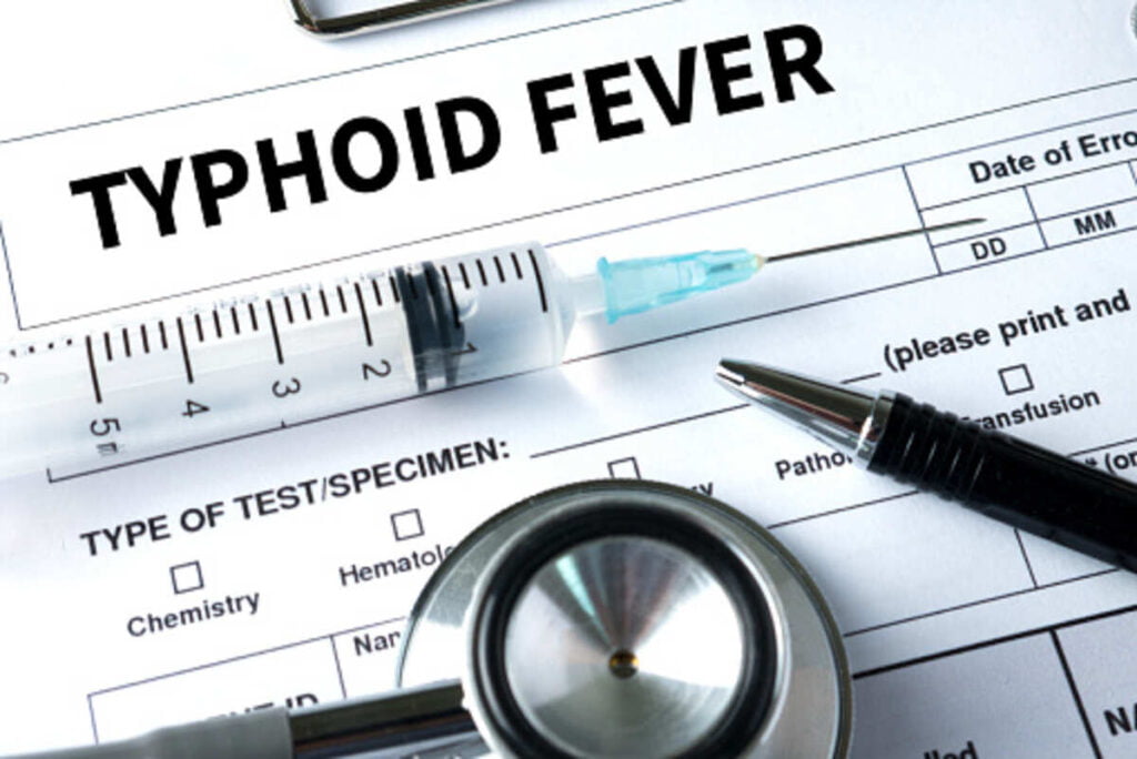 typhoid