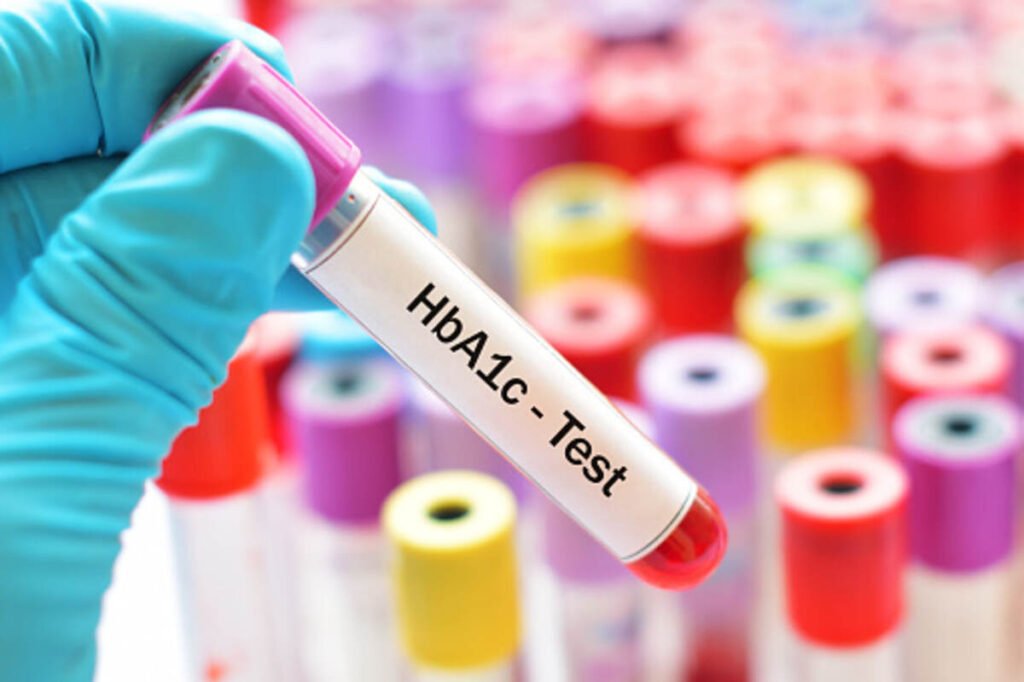 what is a1c