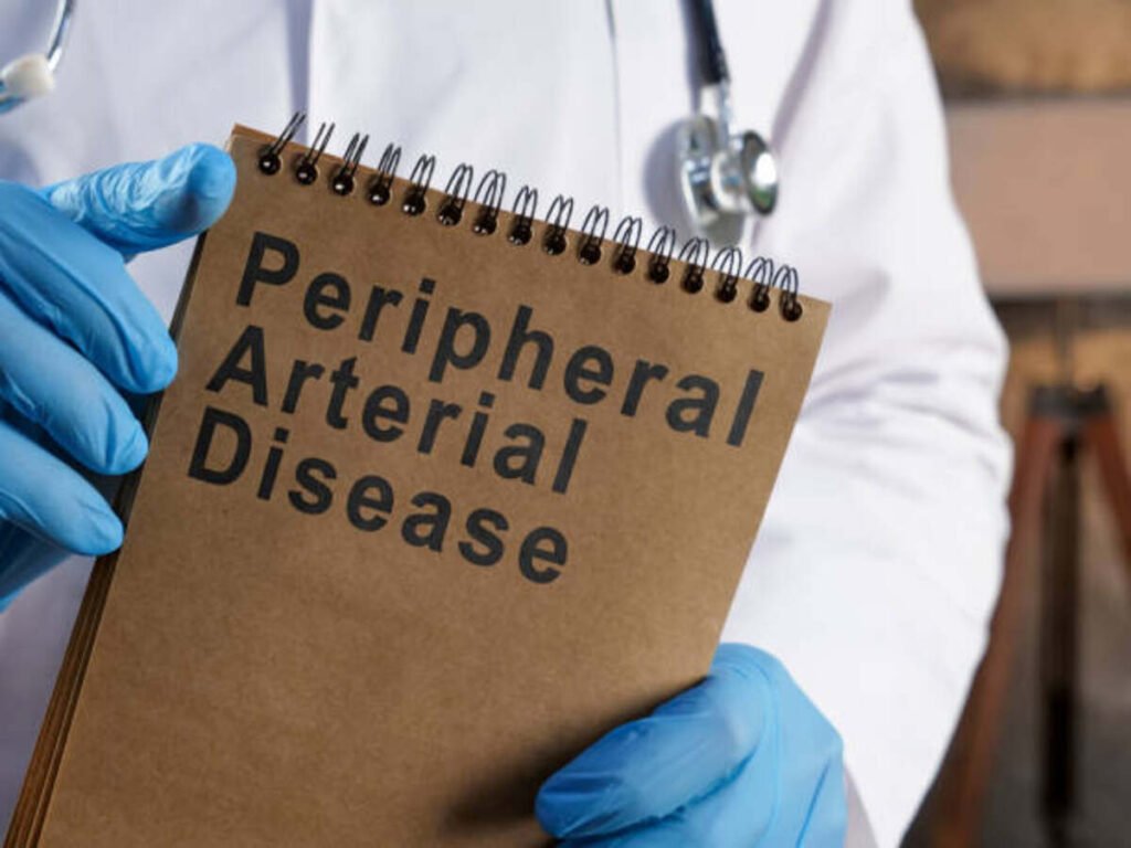 peripheral artery disease