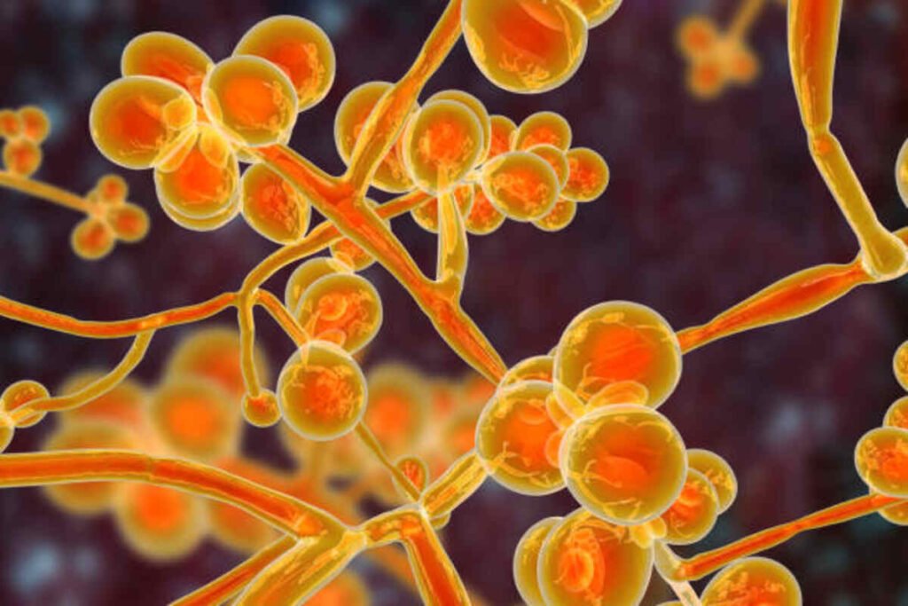 yeast infection symptoms
