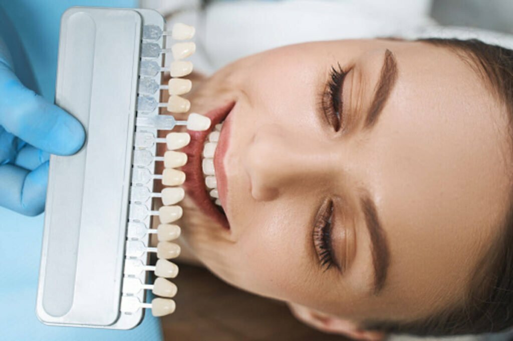 alpha veneers reviews